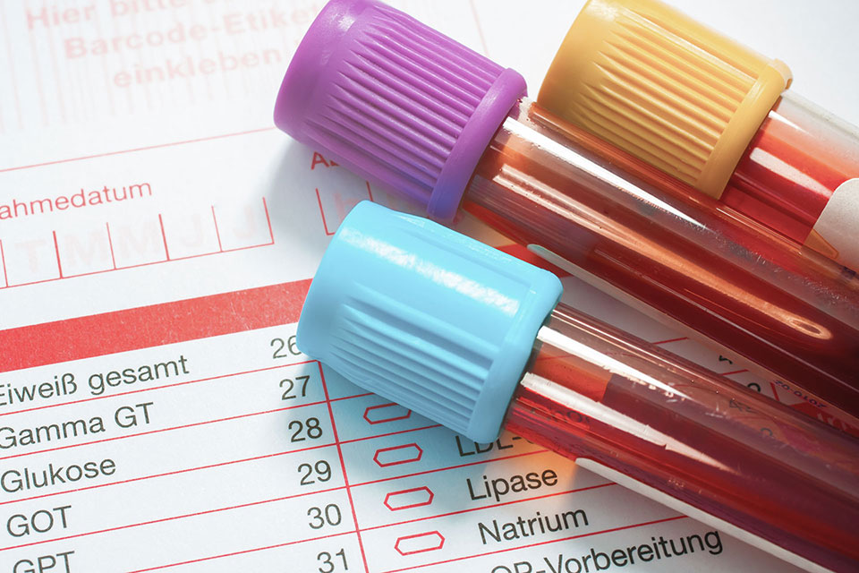 Blutuntersuchung, Blutröllchen und Ergebniszettel